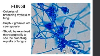 FUNGI
• Colonies of
branching mycelia of
fungi
• Sulphur granules are
seen grossly
• Should be examined
microscopically to
see the branching
mycelia of fungus
 