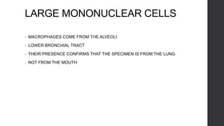 LARGE MONONUCLEAR CELLS
• MACROPHAGES COME FROM THE ALVEOLI
• LOWER BRONCHIAL TRACT
• THEIR PRESENCE CONFIRMS THAT THE SPECIMEN IS FROM THE LUNG
• NOT FROM THE MOUTH
 