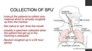 COLLECTION OF SPUTUM
oInstruct the patients to collect only
material which is actually coughed
up from the trachea
oNot saliva or spit ,from the mouth
oUsually a specimen collected when
the patient first get up in the
morning is adequate
oSputum coughed up in a 24 hour
period
 
