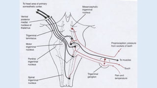 trigeminal neuralgia