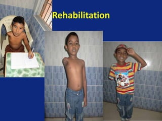 Rehabilitation
 