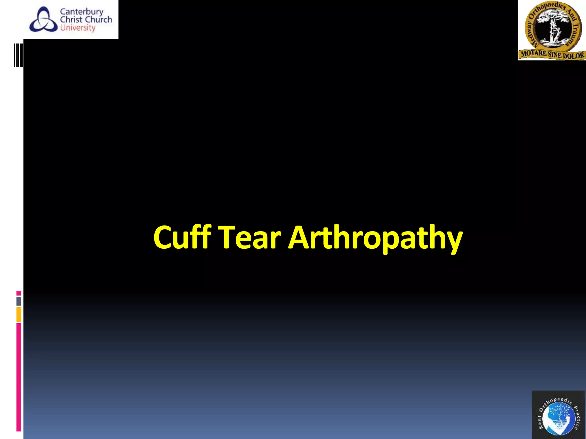 Cuff Tear Arthropathy
21
 