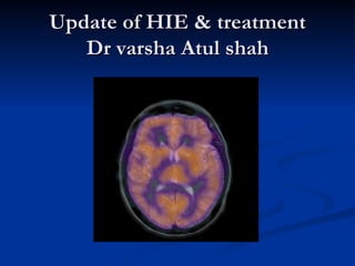 Update of HIE & treatment
   Dr varsha Atul shah
 