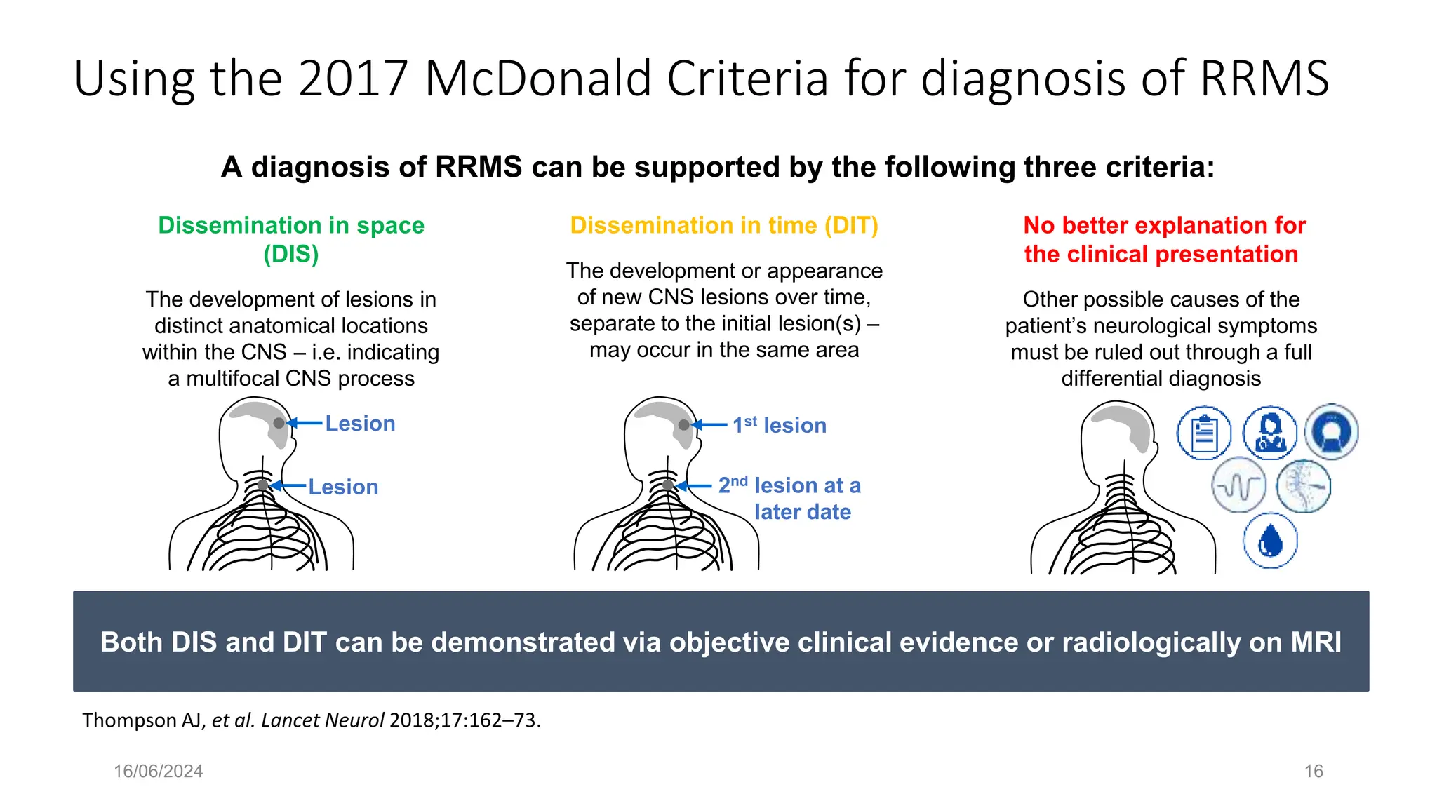 16/06/2024 16
Using the 2017 McDonald Criteria for diagnosis of RRMS
Thompson AJ, et al. Lancet Neurol 2018;17:162–73.
Both DIS and DIT can be demonstrated via objective clinical evidence or radiologically on MRI
Dissemination in space
(DIS)
The development of lesions in
distinct anatomical locations
within the CNS – i.e. indicating
a multifocal CNS process
Lesion
Lesion
Dissemination in time (DIT)
The development or appearance
of new CNS lesions over time,
separate to the initial lesion(s) –
may occur in the same area
1st lesion
2nd lesion at a
later date
No better explanation for
the clinical presentation
Other possible causes of the
patient’s neurological symptoms
must be ruled out through a full
differential diagnosis
A diagnosis of RRMS can be supported by the following three criteria:
 