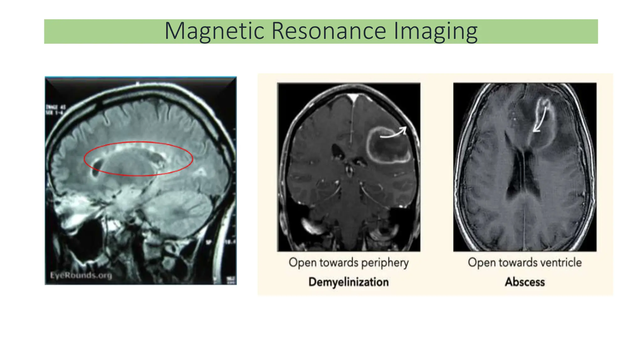Magnetic Resonance Imaging
 