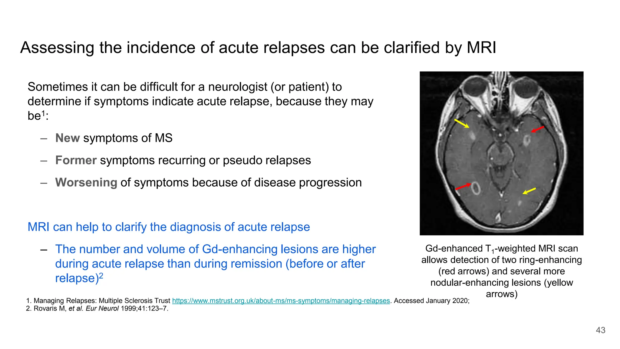 43
Assessing the incidence of acute relapses can be clarified by MRI
Sometimes it can be difficult for a neurologist (or patient) to
determine if symptoms indicate acute relapse, because they may
be1:
– New symptoms of MS
– Former symptoms recurring or pseudo relapses
– Worsening of symptoms because of disease progression
MRI can help to clarify the diagnosis of acute relapse
– The number and volume of Gd-enhancing lesions are higher
during acute relapse than during remission (before or after
relapse)2
1. Managing Relapses: Multiple Sclerosis Trust https://www.mstrust.org.uk/about-ms/ms-symptoms/managing-relapses. Accessed January 2020;
2. Rovaris M, et al. Eur Neurol 1999;41:123‒7.
Gd-enhanced T1-weighted MRI scan
allows detection of two ring-enhancing
(red arrows) and several more
nodular-enhancing lesions (yellow
arrows)
 
