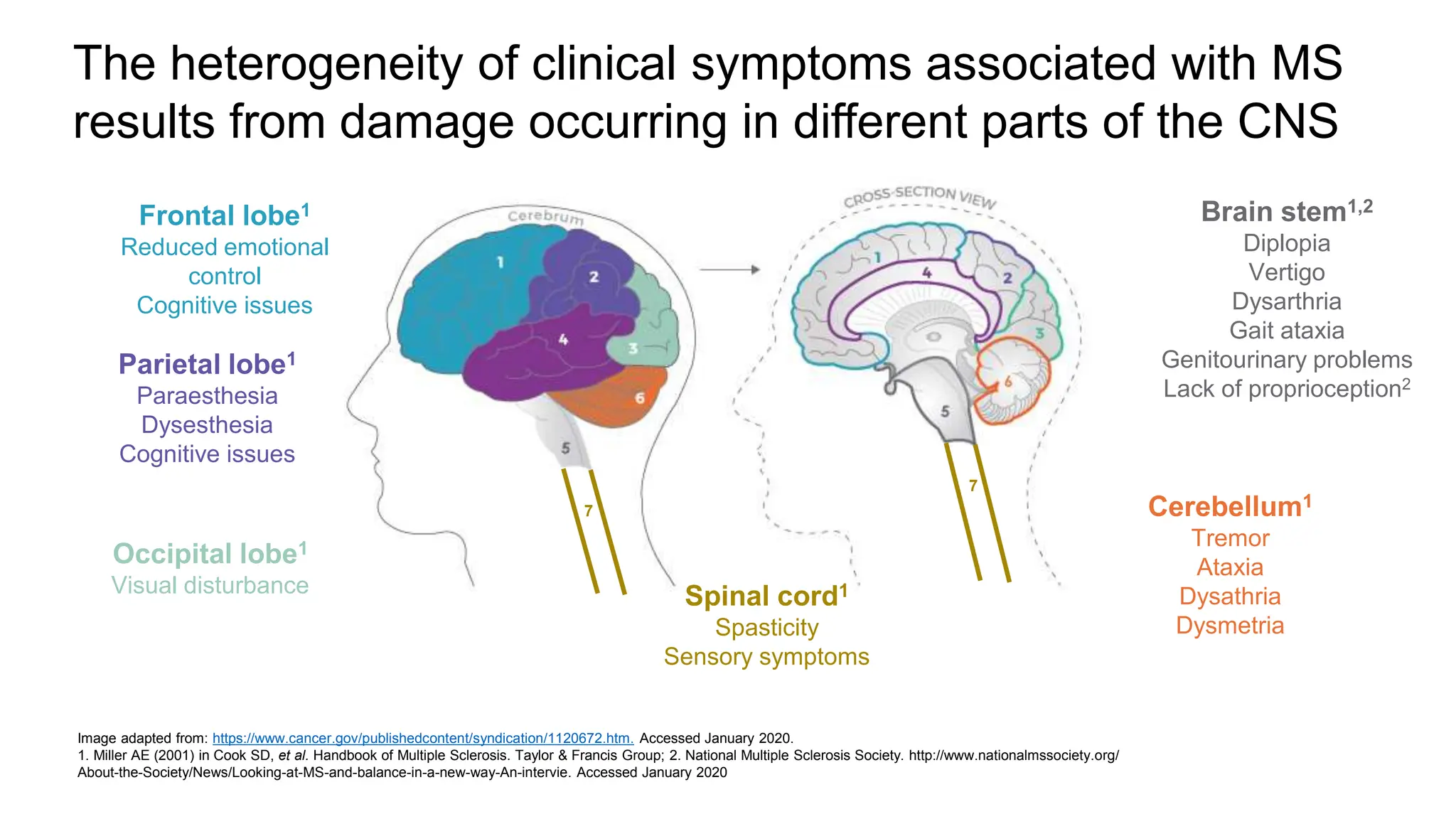 The heterogeneity of clinical symptoms associated with MS
results from damage occurring in different parts of the CNS
Frontal lobe1
Reduced emotional
control
Cognitive issues
Parietal lobe1
Paraesthesia
Dysesthesia
Cognitive issues
Occipital lobe1
Visual disturbance
Cerebellum1
Tremor
Ataxia
Dysathria
Dysmetria
Brain stem1,2
Diplopia
Vertigo
Dysarthria
Gait ataxia
Genitourinary problems
Lack of proprioception2
7
Spinal cord1
Spasticity
Sensory symptoms
7
Image adapted from: https://www.cancer.gov/publishedcontent/syndication/1120672.htm. Accessed January 2020.
1. Miller AE (2001) in Cook SD, et al. Handbook of Multiple Sclerosis. Taylor & Francis Group; 2. National Multiple Sclerosis Society. http://www.nationalmssociety.org/
About-the-Society/News/Looking-at-MS-and-balance-in-a-new-way-An-intervie. Accessed January 2020
 
