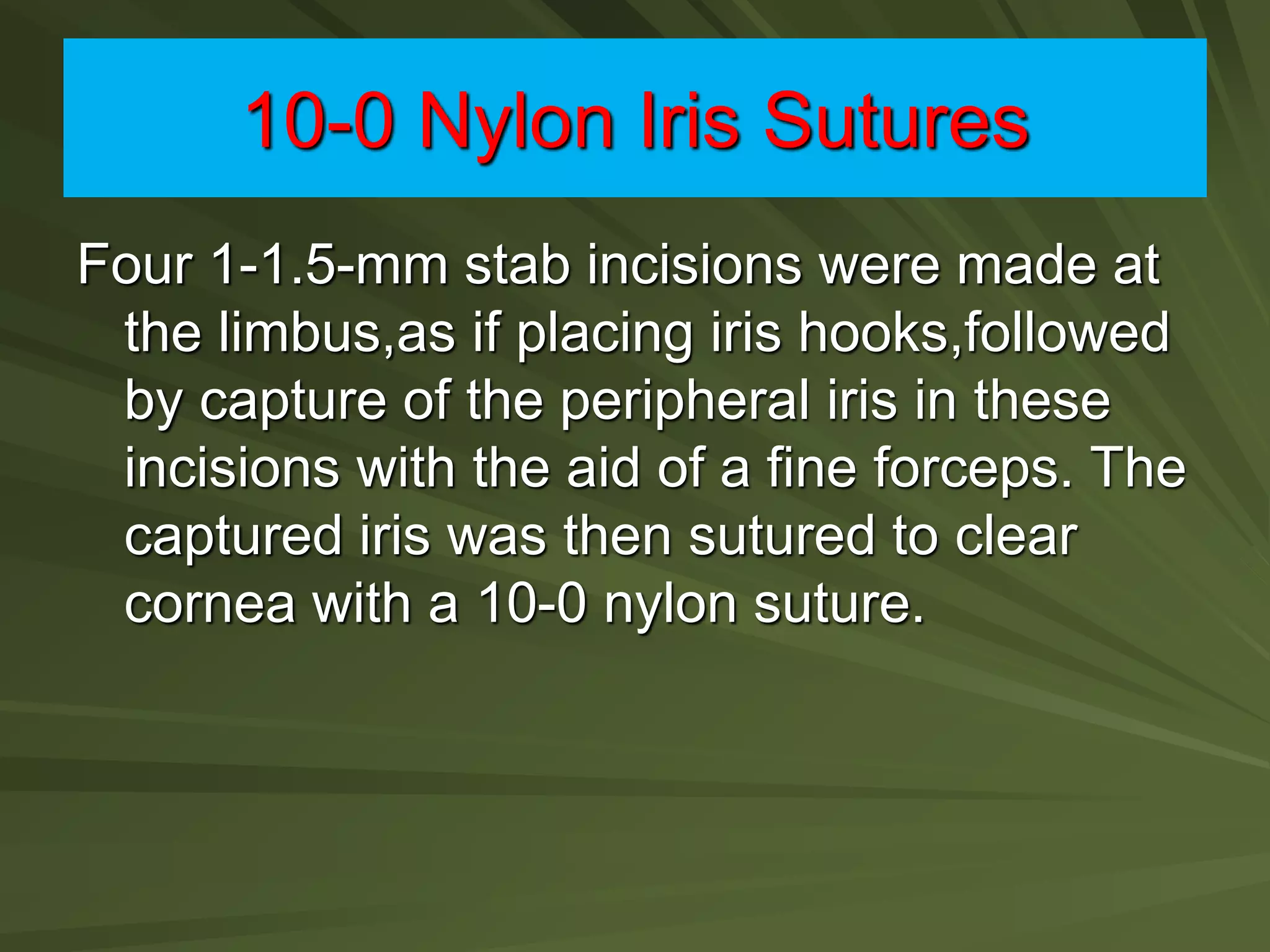 10-0 Nylon Iris Sutures
Four 1-1.5-mm stab incisions were made at
the limbus,as if placing iris hooks,followed
by capture of the peripheral iris in these
incisions with the aid of a fine forceps. The
captured iris was then sutured to clear
cornea with a 10-0 nylon suture.
 