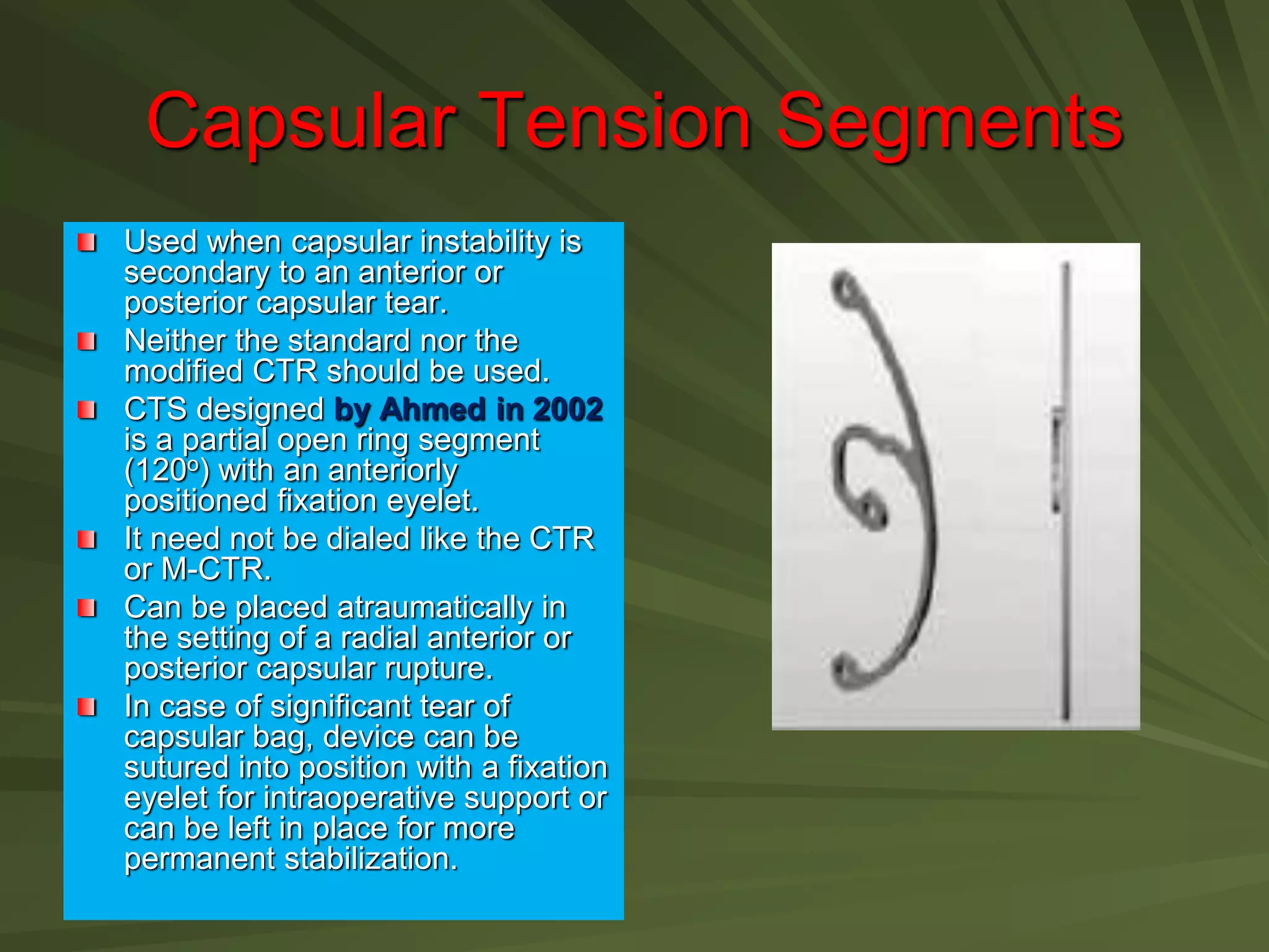 Capsular Tension Segments
Used when capsular instability is
secondary to an anterior or
posterior capsular tear.
Neither the standard nor the
modified CTR should be used.
CTS designed by Ahmed in 2002
is a partial open ring segment
(120o) with an anteriorly
positioned fixation eyelet.
It need not be dialed like the CTR
or M-CTR.
Can be placed atraumatically in
the setting of a radial anterior or
posterior capsular rupture.
In case of significant tear of
capsular bag, device can be
sutured into position with a fixation
eyelet for intraoperative support or
can be left in place for more
permanent stabilization.
 