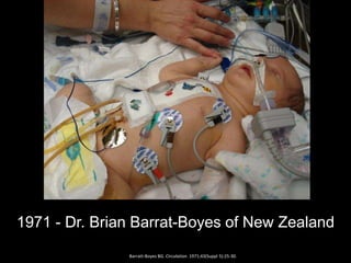 1971 - Dr. Brian Barrat-Boyes of New Zealand
Barratt-Boyes BG. Circulation. 1971;43(Suppl 5):25-30.
 