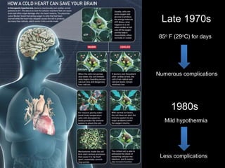 Late 1970s
1980s
85o F (29oC) for days
Mild hypothermia
Numerous complications
Less complications
 
