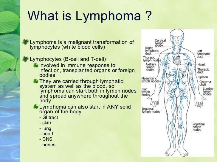 Update on treatment for lymphoma, Lymphoma Support Ireland