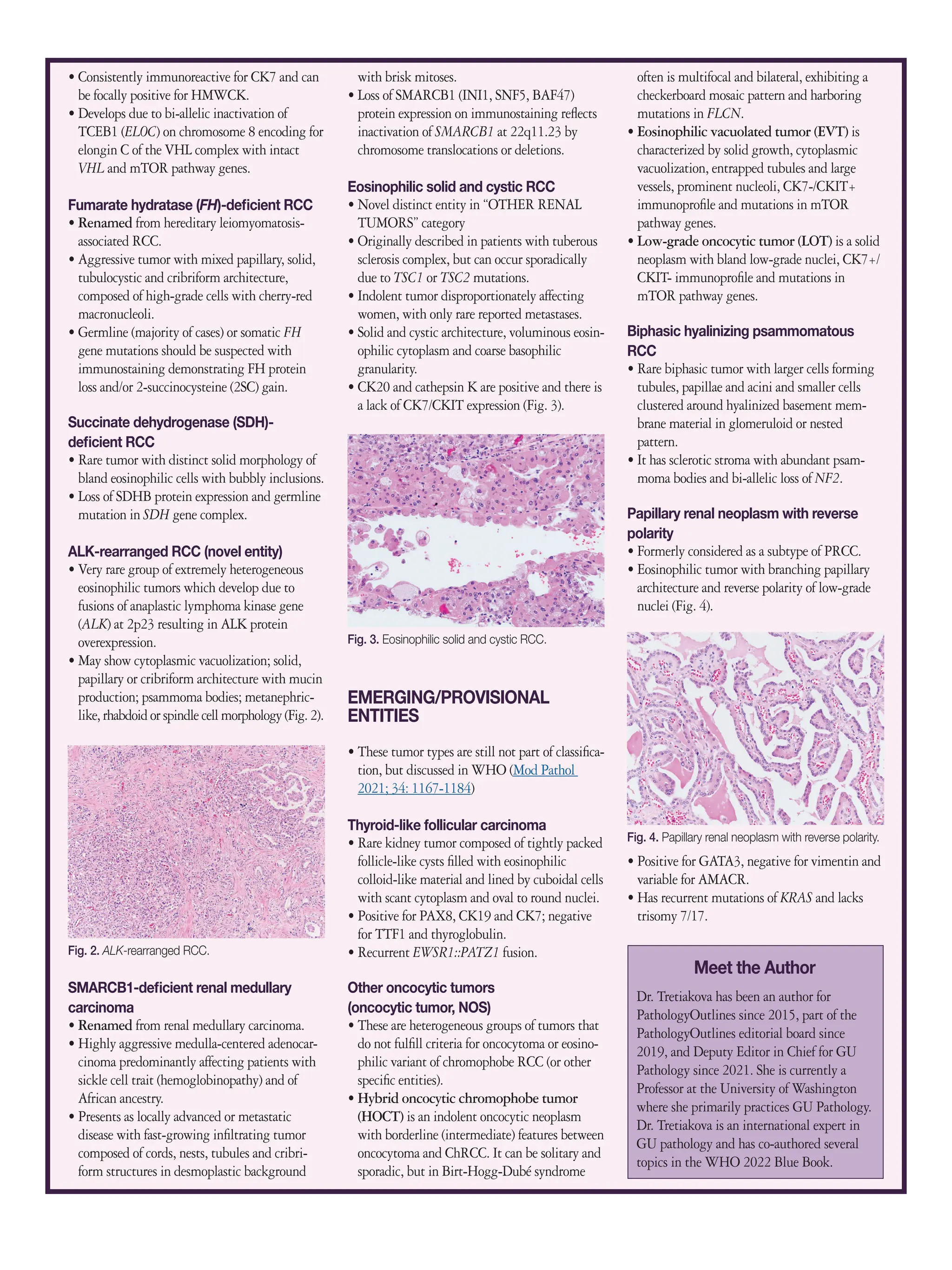 Updates-Kidney Pathology WHO tumor updates | PDF