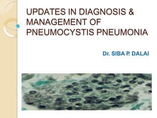 UPDATES IN DIAGNOSIS &
MANAGEMENT OF
PNEUMOCYSTIS PNEUMONIA
Dr. SIBA P
. DALAI
 