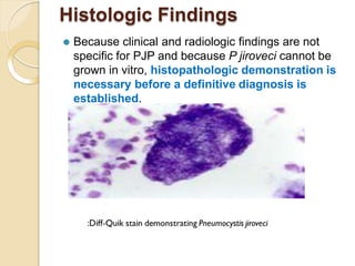 updatesindiagnosismanagementofpneumocystispneumonia-150503095358 ...