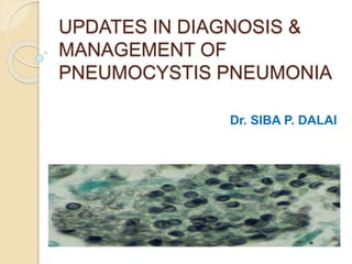 UPDATES IN DIAGNOSIS &
MANAGEMENT OF
PNEUMOCYSTIS PNEUMONIA
Dr. SIBA P. DALAI
 