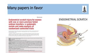 Many papers in favor
 