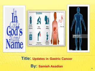 Title: Updates in Gastric Cancer
By: Samieh Asadian
1
 