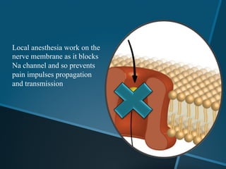 How Local Anesthesia Works Updates in local anesthesia technique | PDF