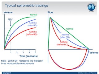 © Global Initiative for Asthma
Time (seconds)
Volume
Note: Each FEV1 represents the highest of
three reproducible measurements
Typical spirometric tracings
FEV1
1 2 3 4 5
Normal
Asthma
(after BD)
Asthma
(before BD)
Flow
Volume
Normal
Asthma
(after BD)
Asthma
(before BD)
GINA 2017
 