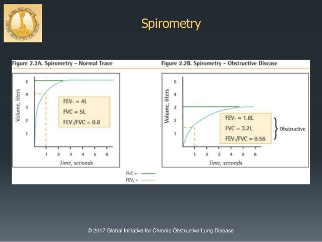 Updates in pulmonary medicine 2017