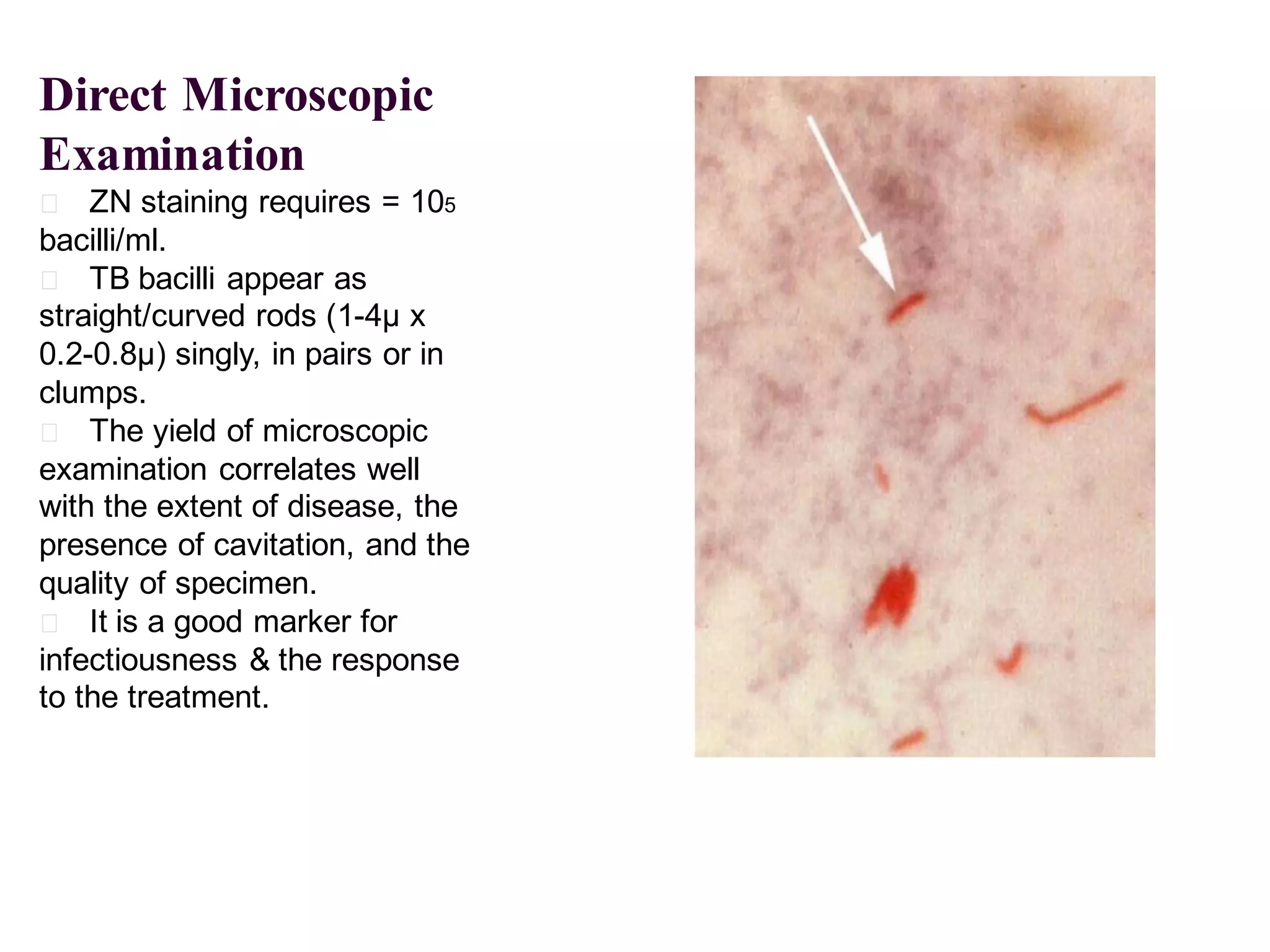 Direct Microscopic
Examination
􀂄 ZN staining requires = 105

bacilli/ml.
􀂄 TB bacilli appear as
straight/curved rods (1-4μ x
0.2-0.8μ) singly, in pairs or in
clumps.
􀂄 The yield of microscopic
examination correlates well
with the extent of disease, the
presence of cavitation, and the
quality of specimen.
􀂄 It is a good marker for
infectiousness & the response
to the treatment.

 