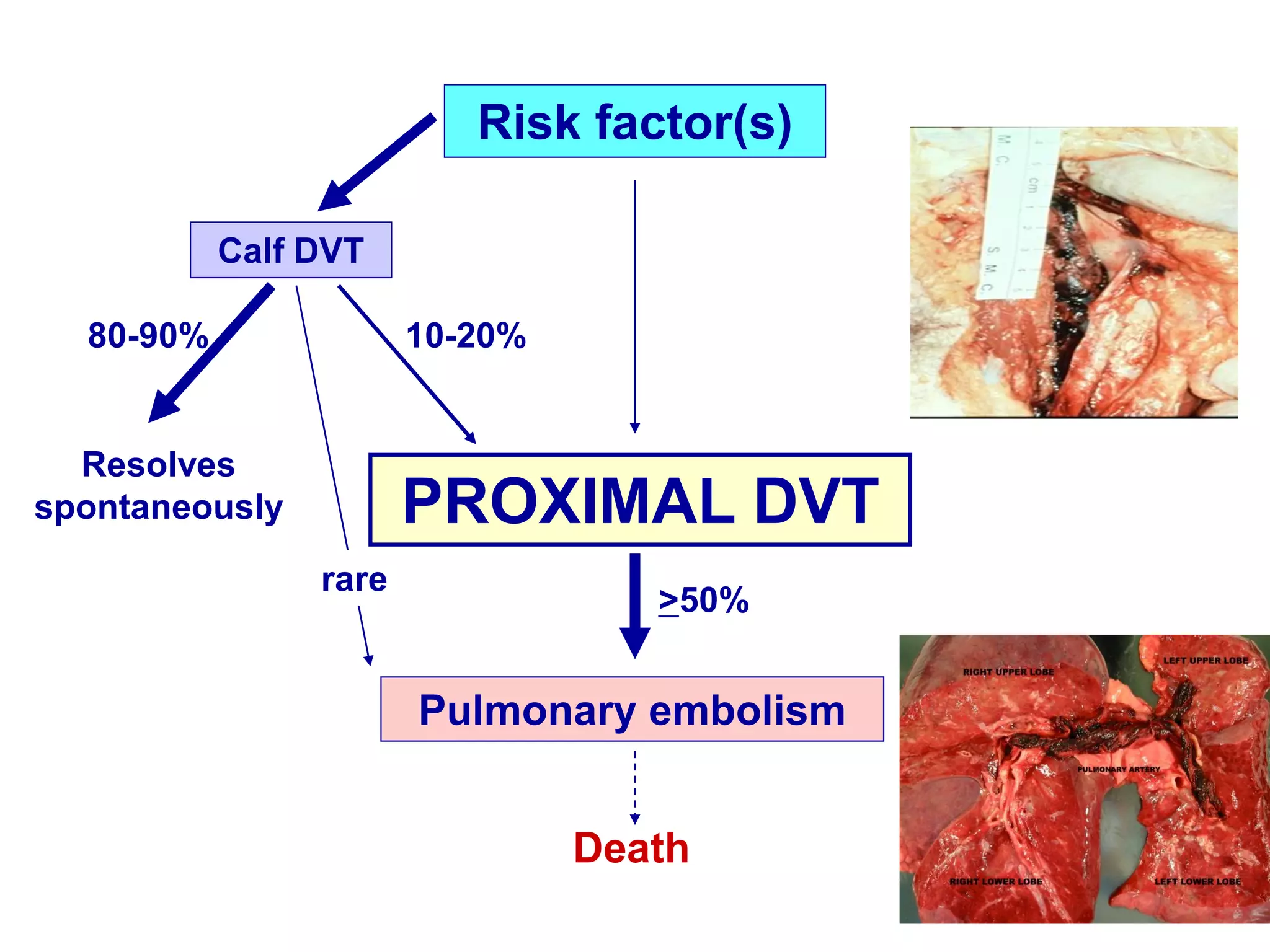 Updates in venous thromboembolism | PDF