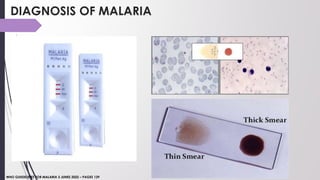 Regger Malatis UPDATES ON MALARIA 2022.pptx