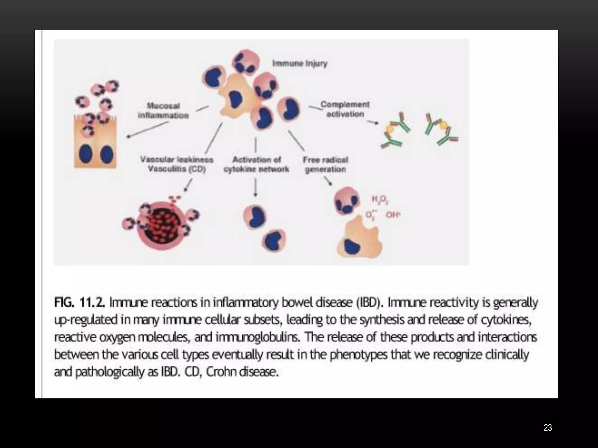 Pathology of Inflammatory bowel disease | PPTX