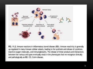 Pathology of Inflammatory bowel disease | PPTX