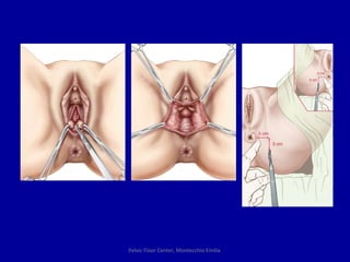 Pelvic Floor Center, Montecchio Emilia  