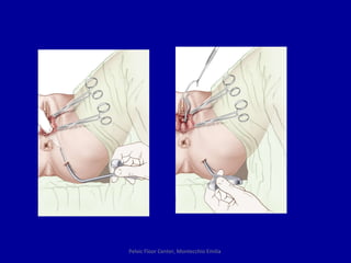 Pelvic Floor Center, Montecchio Emilia  