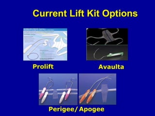 Current Lift Kit Options Prolift Avaulta Perigee/ Apogee 