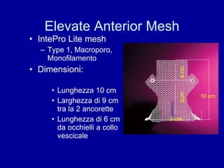 Elevate Anterior Mesh IntePro Lite mesh Type 1, Macroporo, Monofilamento Dimensioni: Lunghezza 10 cm Larghezza di 9 cm tra la 2 ancorette Lunghezza di 6 cm da occhielli a collo vescicale 9 cm 4 cm 6cm 10 cm 
