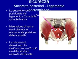 Misurazione per valutare la sicurezza Ancorette posteriori - Legamento sacrospinoso Le ancorette sono posizionate nel legamento a 2 cm dalla spina ischiatica Misurazione di vasi e nervi ottenute in relazione alla posizione delle ancorette Le misurazioni dimostrano che vasi/nervi sono a 2 o più cm dalle strutture coinvolte da Elevate Posizionamento Elevate 
