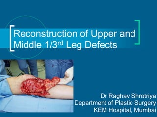 Dr Raghav Shrotriya
Department of Plastic Surgery
KEM Hospital, Mumbai
Reconstruction of Upper and
Middle 1/3rd Leg Defects
 