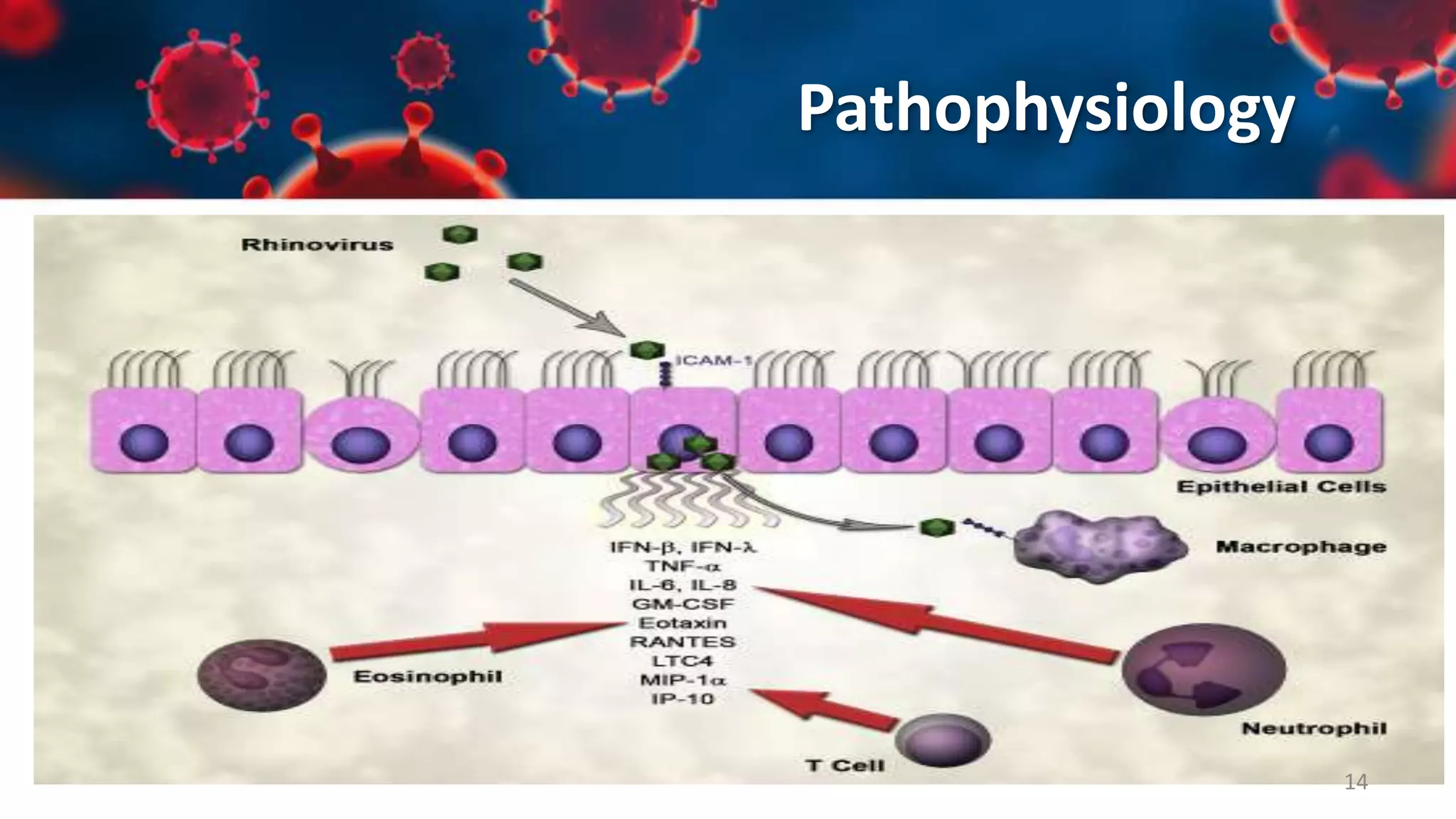 Upper Respiratory Tract Infections