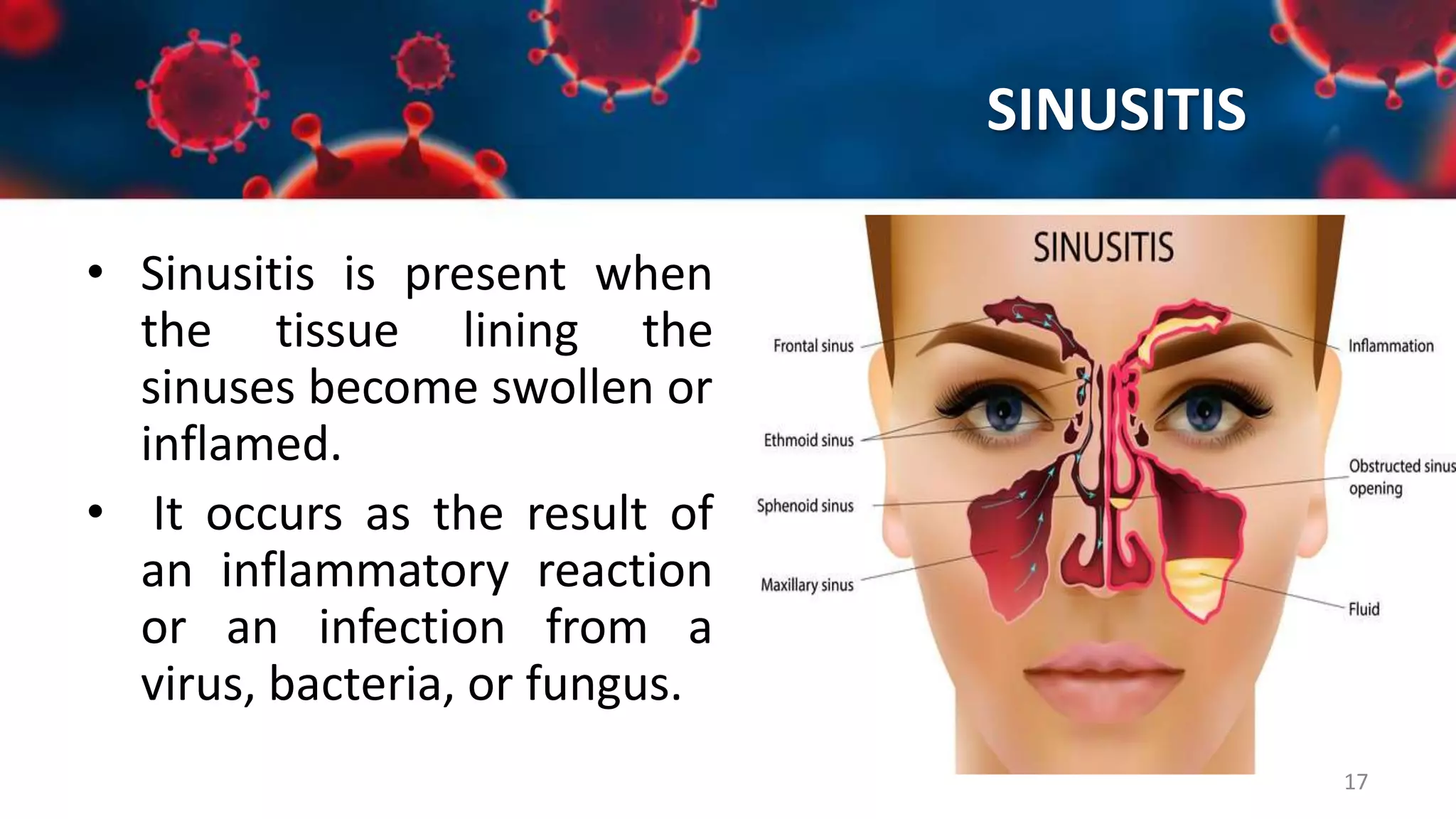 Upper Respiratory Tract Infections