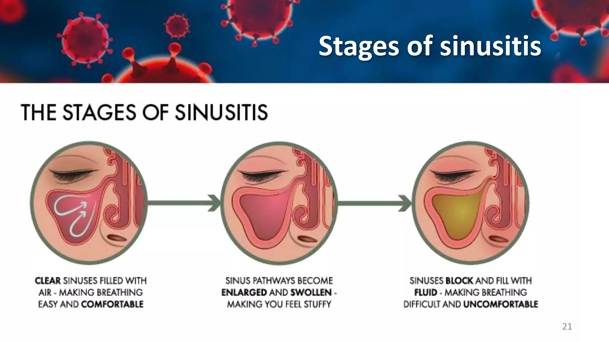Upper Respiratory Tract Infections