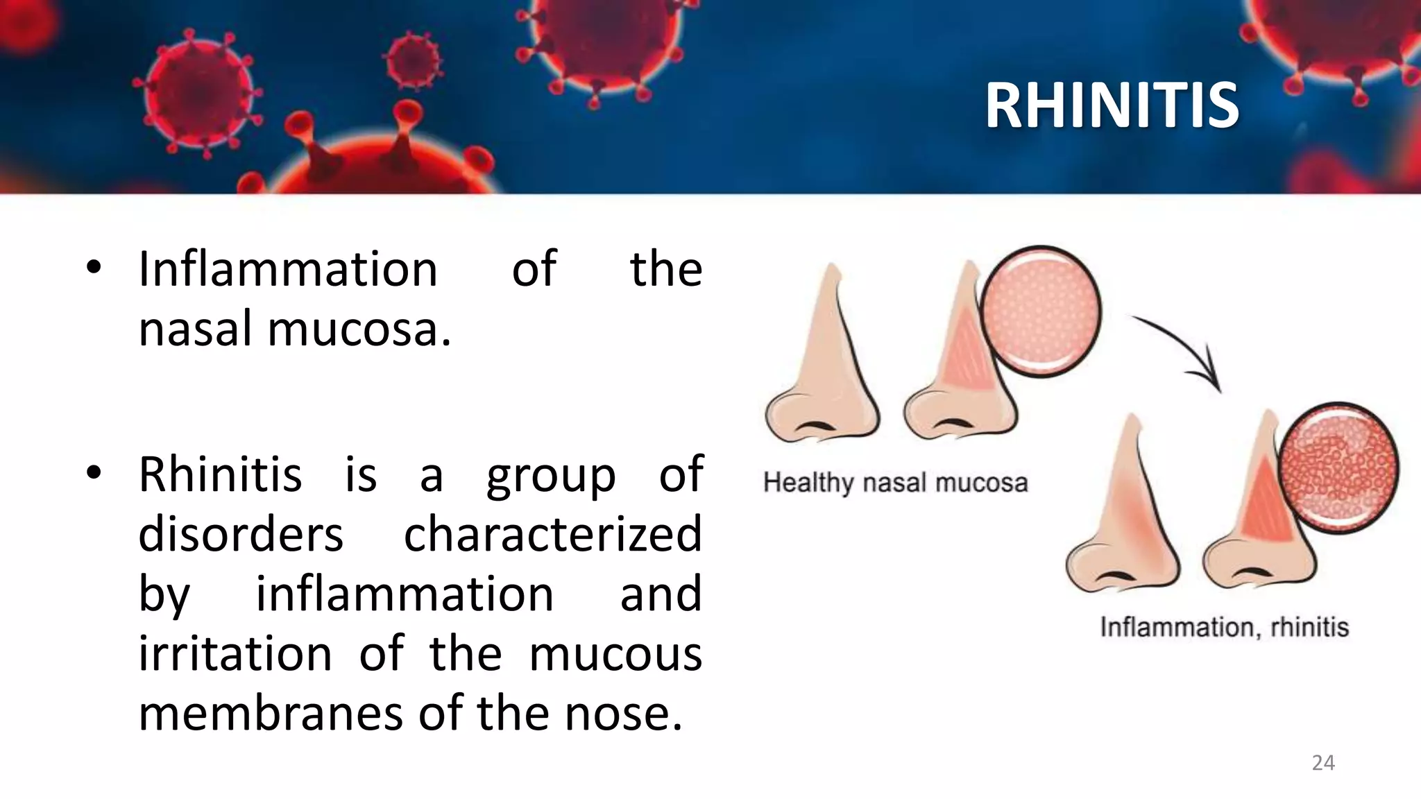 Upper Respiratory Tract Infections