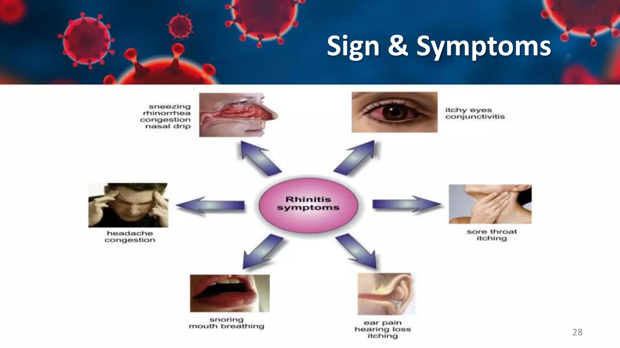 Upper Respiratory Tract Infections