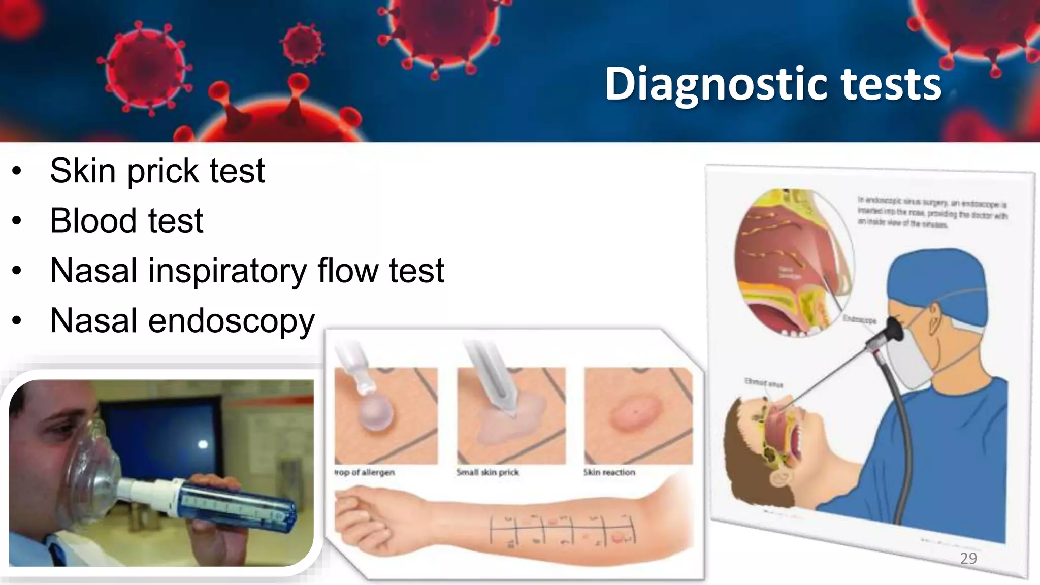 Upper Respiratory Tract Infections