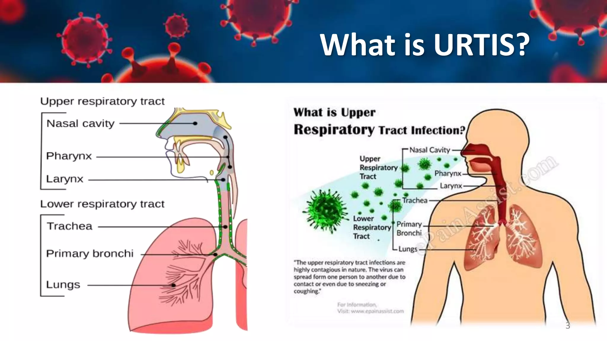 Upper Respiratory Tract Infections