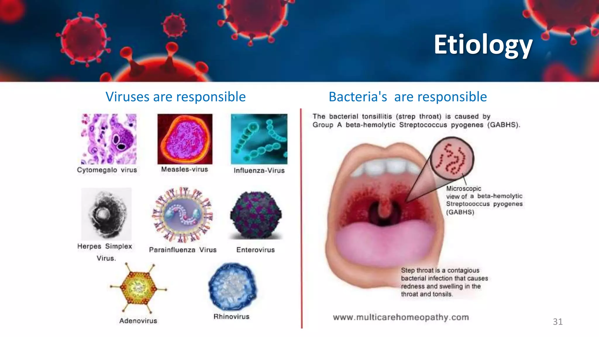 Upper Respiratory Tract Infections