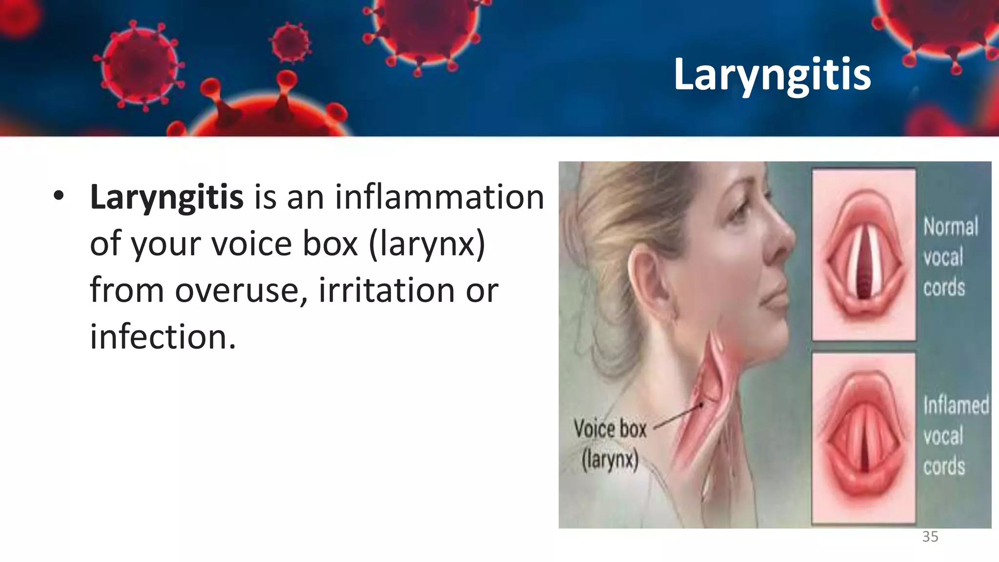 Upper Respiratory Tract Infections