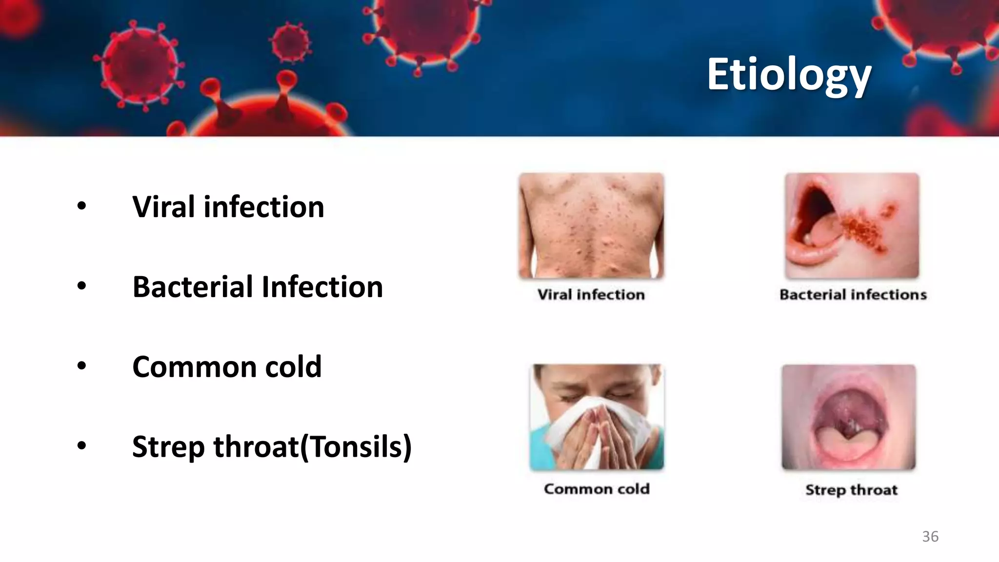 Upper Respiratory Tract Infections