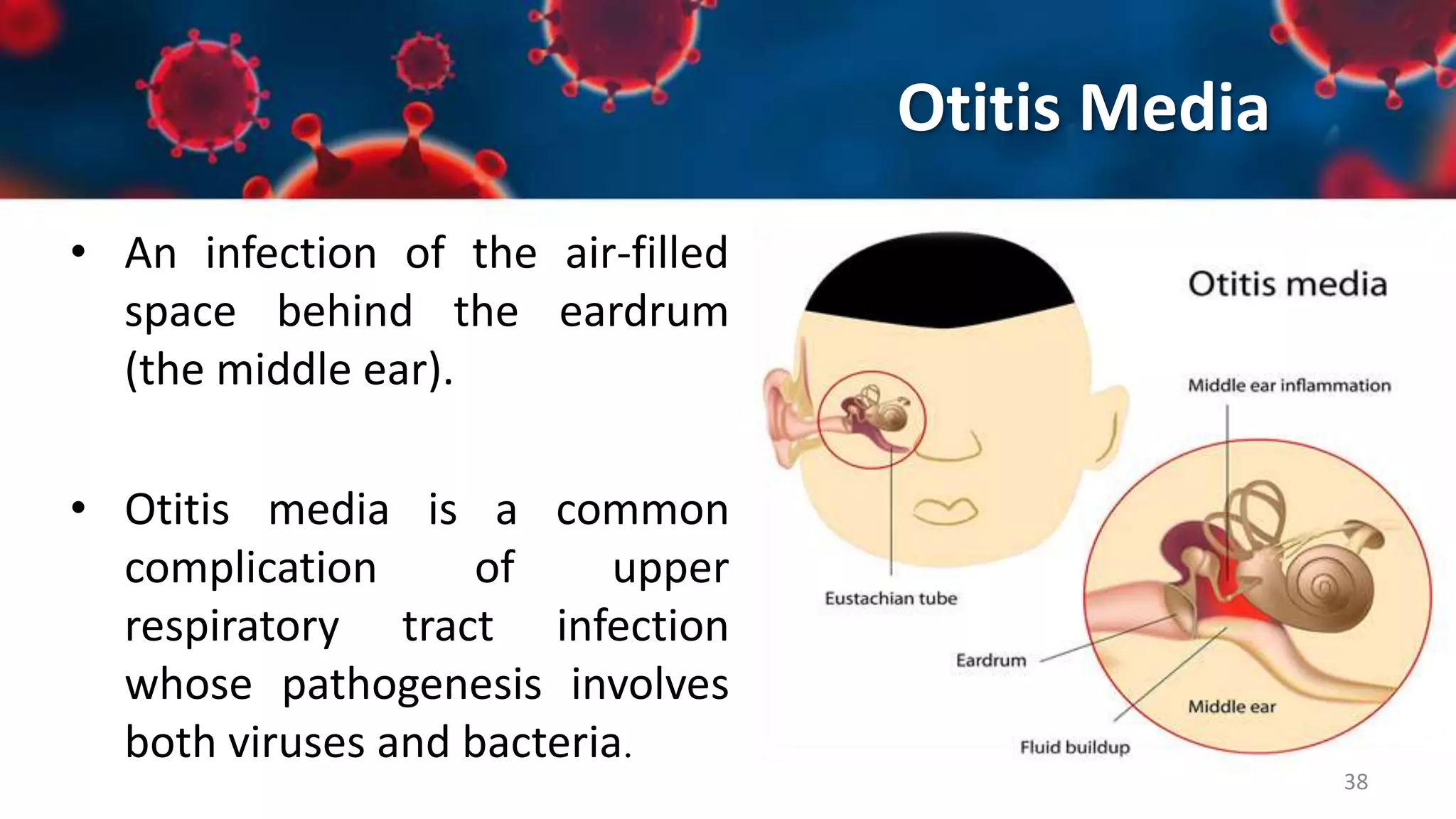 Upper Respiratory Tract Infections