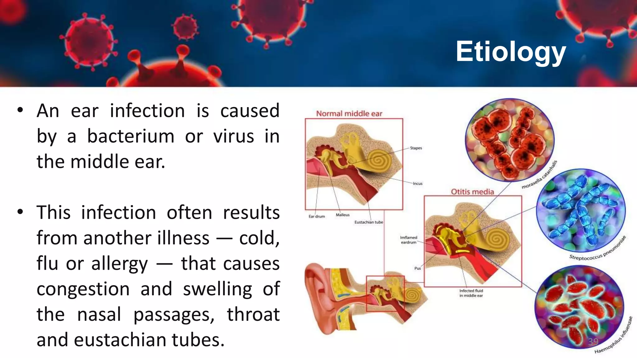 Upper Respiratory Tract Infections