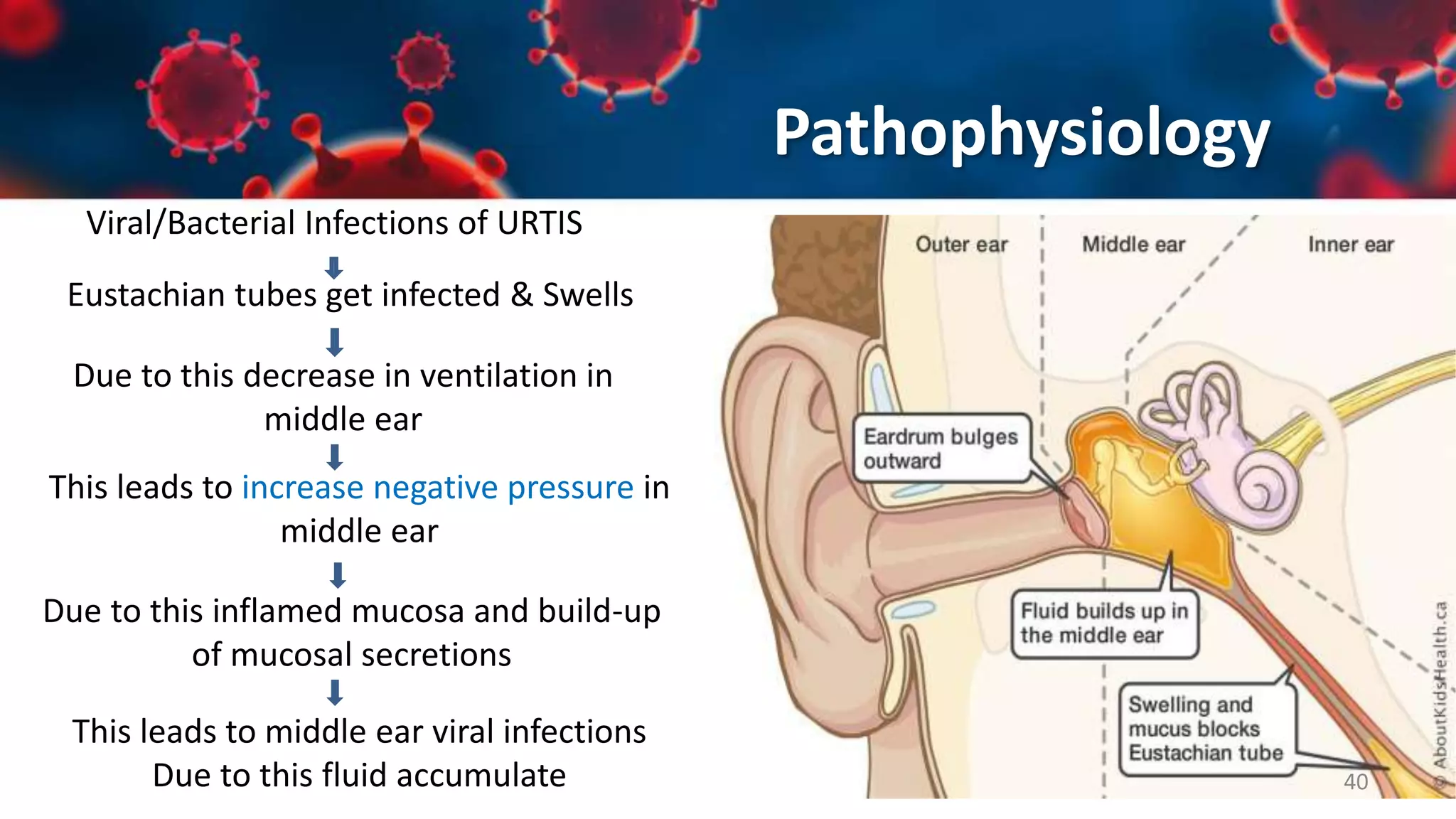 Upper Respiratory Tract Infections