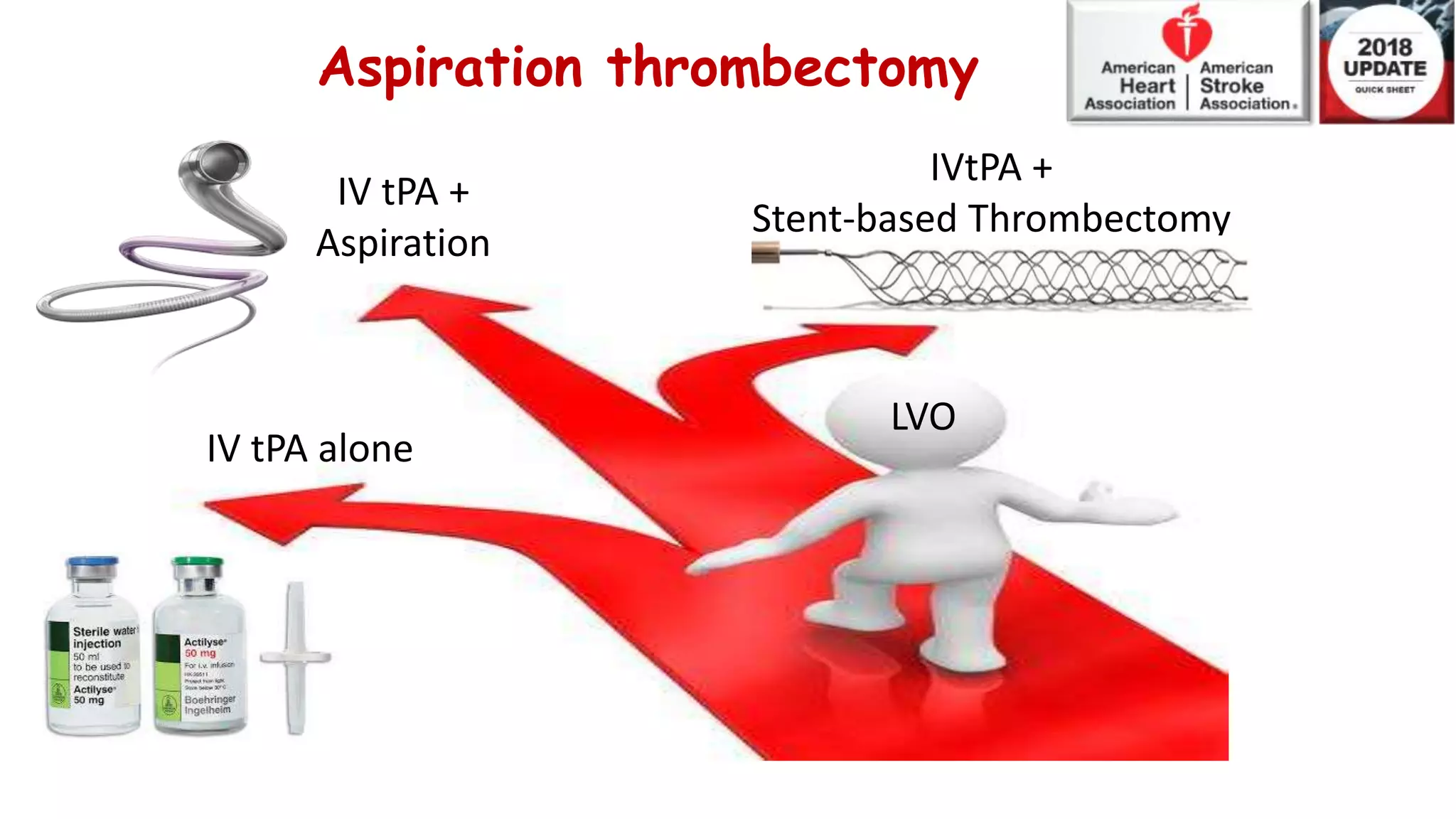 Aspiration vs Mechanical Thrombectomy | PPTX | Blood Disorders ...